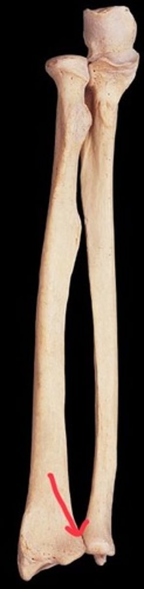 <p>distal radioulnar joint</p>