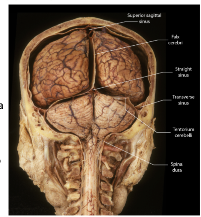 <p>Between the <strong>2 Cerebrum hemispheres</strong>, in the<u> longitudinal fissure</u>. (vertically)</p>