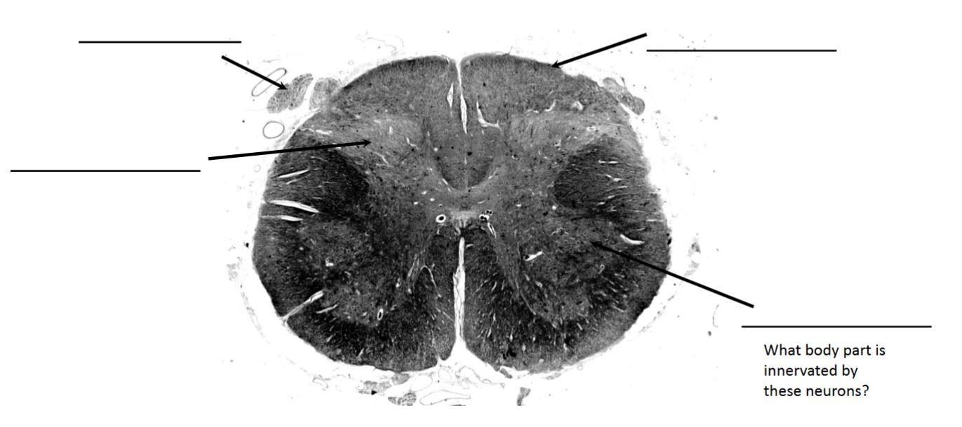 <p>identify this spinal level</p>