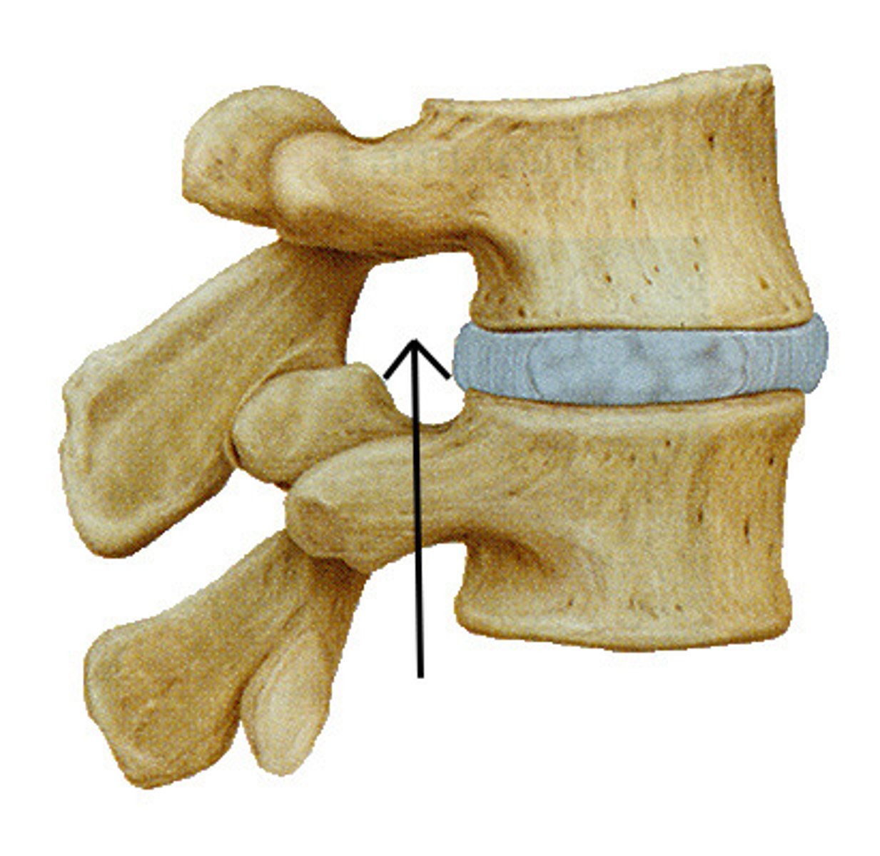 <p>opening located between adjacent vertebrae for exit of a spinal nerve</p>
