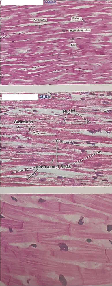 <ul><li><p>Found only in the heart</p></li><li><p>Branching fibers</p></li><li><p>striated appearance with intercalated discs</p></li><li><p>1-2 nuclei per cell </p></li><li><p>Involuntary muscle</p></li><li><p>Demonstrated autorhythmicity</p><ul><li><p>  Pacemakers</p></li><li><p>Stimulated by ANS and Hormones   </p></li></ul></li></ul><p></p>