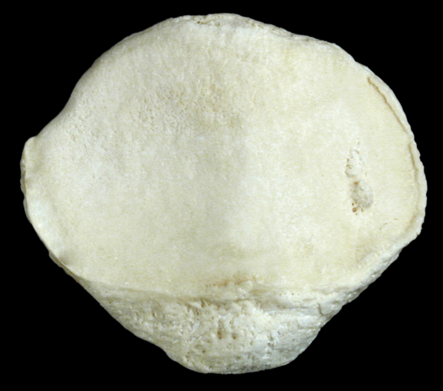 <p>bumpier back side with two facets on patella </p>