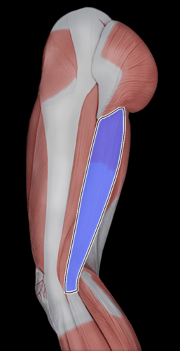 <p>What Muscle Is Highlighted?</p>