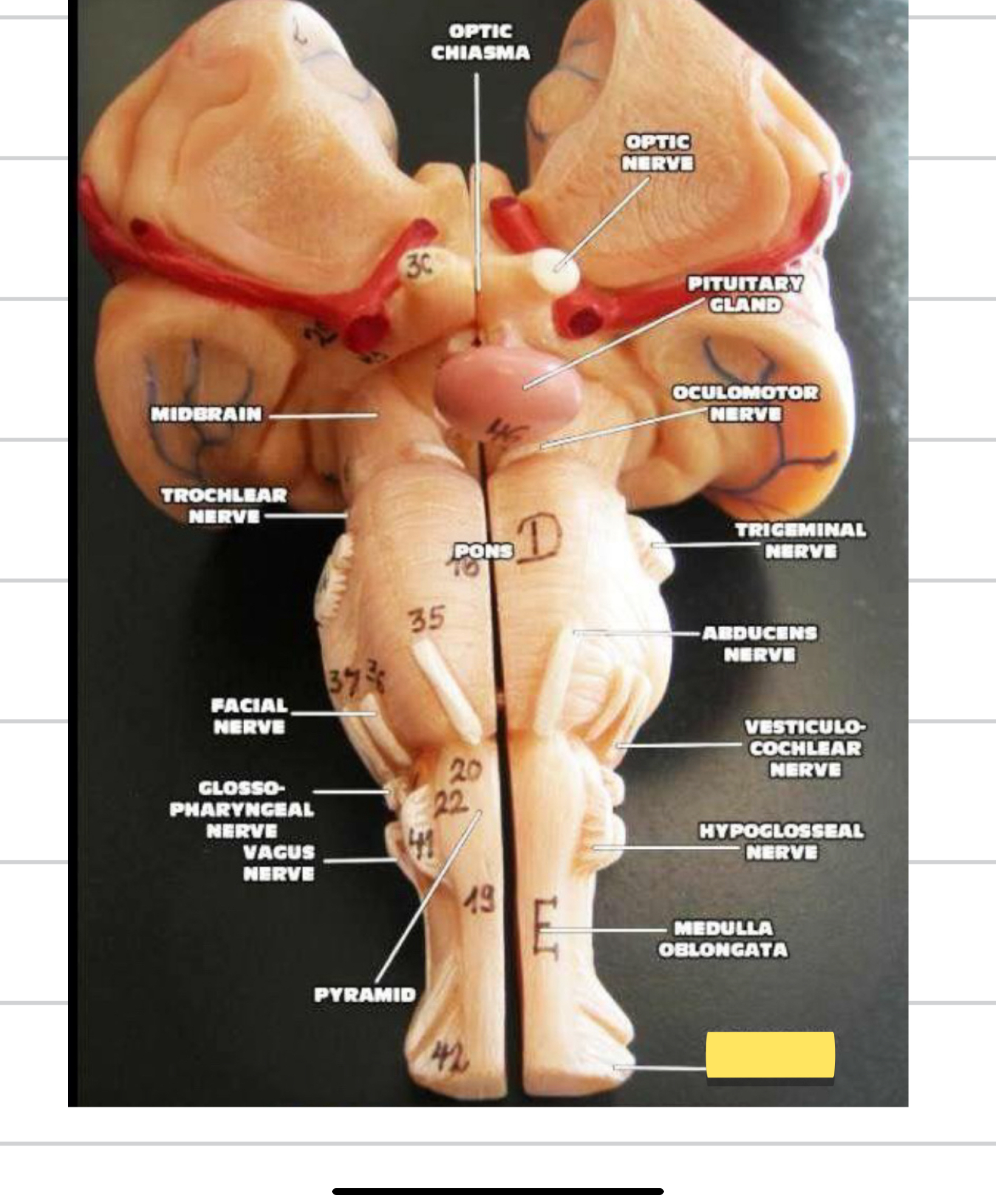 <p>Name this cranial nerve&nbsp;</p>