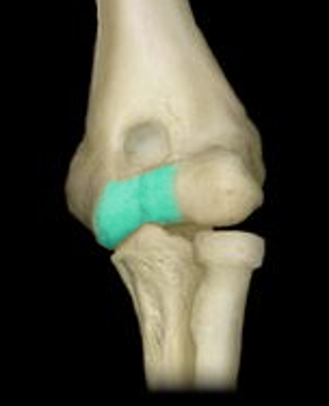 <p>pulley shaped area on the medial side of the distal humerus</p>