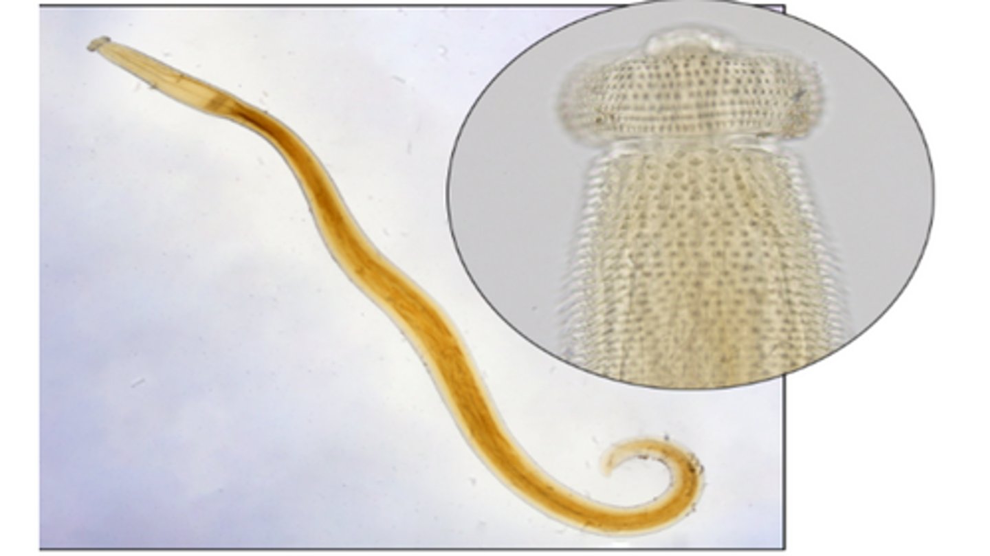 <p>Nematodes that infects the stomach of mammals (including humans)</p><p>-1st IH: freshwater copepods</p><p>-2nd IH: Freshwater fish & amphibians </p><p>-Adults & larvae have cuticular spines along the anterior portion of the body with a prominent cephalic bulb</p><p>-Unembryonated, operculated eggs are passed in feces </p>