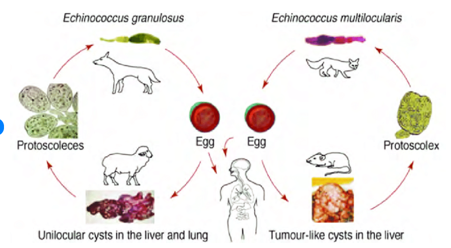 <p><strong>t</strong>wo species of tapeworms that cause <strong>hydatid disease</strong> in humans and animals.</p><p><strong>Life Cycle of Echinococcus granulosus → hyatidosis</strong></p><ol><li><p><strong>Eggs</strong>:</p><ul><li><p>Eggs are released into the environment through the feces of the FH ex. dog</p></li><li><p>These eggs contain <strong>oncospheres</strong>, the infective stage.</p></li></ul></li><li><p><strong>Intermediate Host (Sheep, Cattle, Humans)</strong>:</p><ul><li><p>ingest the eggs from contaminated food, water, or soil.</p></li><li><p>In the intestine, the eggs hatch into <strong>oncospheres</strong> → <strong>liver</strong> or <strong>lungs</strong>.</p></li><li><p>develops into unilocular hyatid cysts with <strong>protoscoleces (larval forms)</strong></p></li></ul></li><li><p><strong>Definitive Host (Dogs or Canines)</strong></p><ul><li><p>In the dog’s intestine, the protoscoleces develop into adult tapeworms, completing the cycle.</p></li></ul></li></ol><p><strong>Life Cycle of Echinococcus multilocularis → alveococcis</strong></p><p><em>location: liver, lung, heart, brain, bone marrow, muscle, lymph nodes. DH: fox, dog, wild canids, racoon, cat. IH: rodents + human. </em></p><ol><li><p><strong>Eggs</strong>:</p><ul><li><p>Similar to E. granulosus, eggs are released into the environment through the feces of the definitive host (usually foxes or other wild canines).</p></li><li><p>Eggs contain <strong>oncospheres</strong>.</p></li></ul></li><li><p><strong>Intermediate Host (Rodents, Humans)</strong>:</p><ul><li><p>ingest the eggs from contaminated food, water, or soil.</p></li><li><p>In the intestine, the eggs hatch into <strong>oncospheres</strong> → <strong>liver</strong>.</p></li><li><p>In the liver, they develop into <strong>multilocular cysts</strong>, which grow in a tumor-like manner and contain <strong>protoscoleces</strong>.</p></li><li><p>also Alveolar cysts</p></li></ul></li><li><p><strong>Definitive Host (Foxes or Wild Canines)</strong>:</p><ul><li><p>In the intestine, the protoscoleces develop into adult tapeworms, completing the cycle.</p></li></ul></li></ol><p></p>