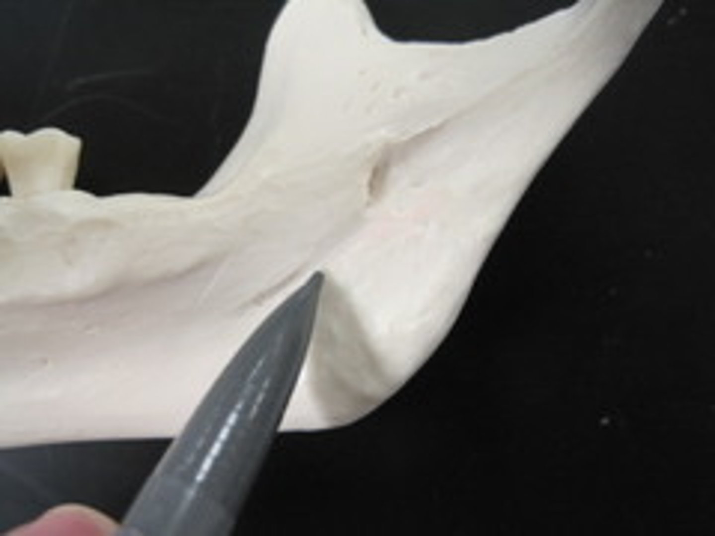 <p><em>identify the structure:</em></p>
