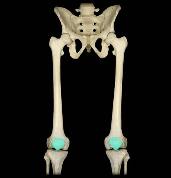 <p>identify the name of the bone</p>