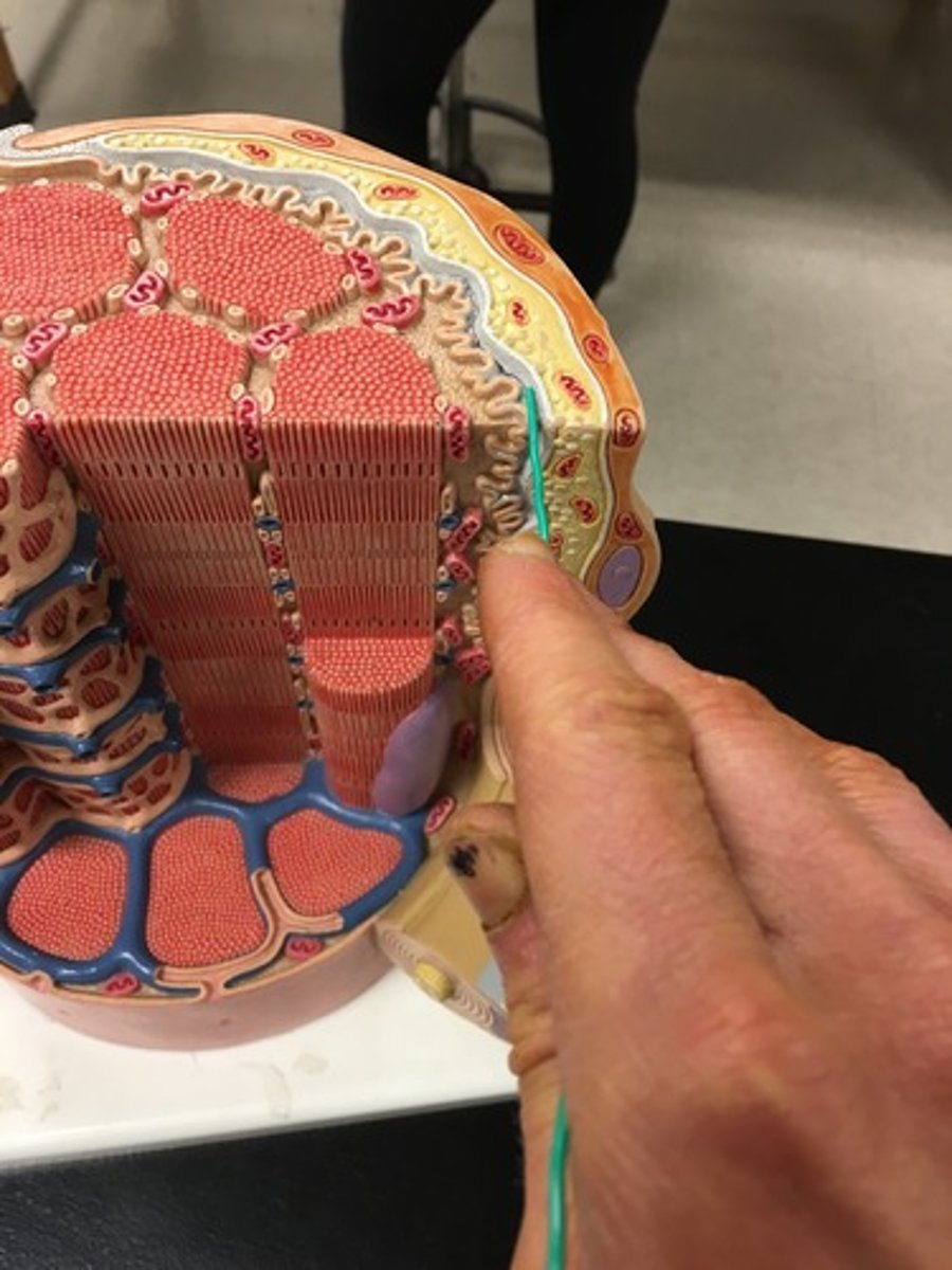 <p>(number 4 in the image)</p>