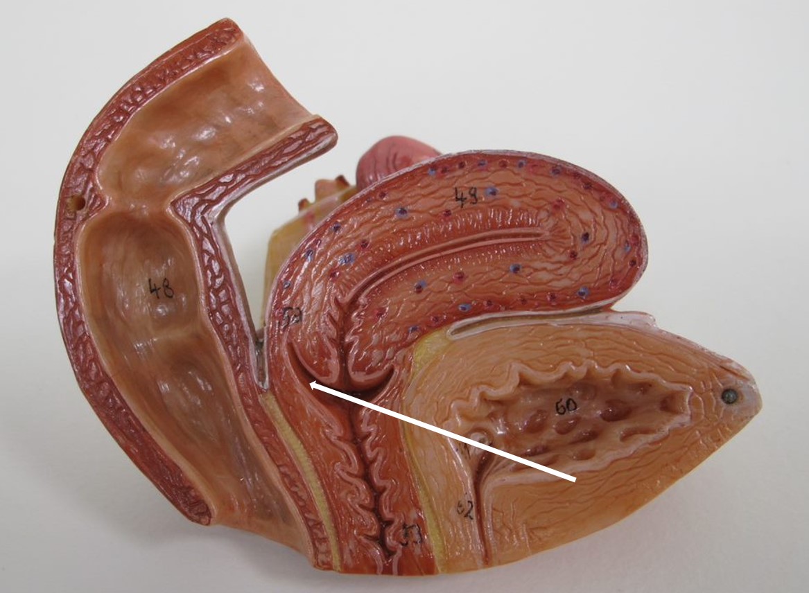 <p>deel vagina</p>