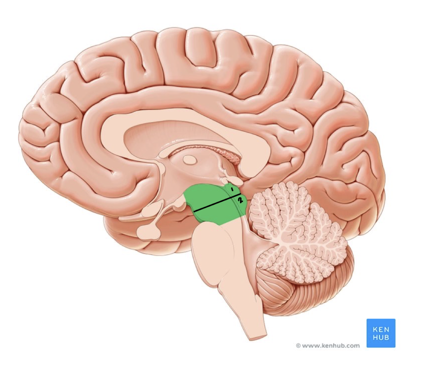<p>What part of the midbrain is labeled 1?</p>