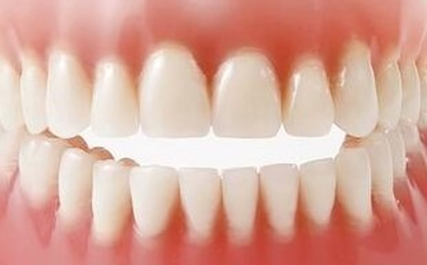 <p>Which incisor is the smallest tooth in the mouth?</p>