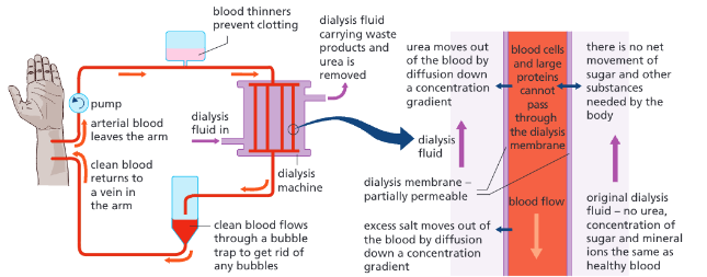 <ul><li><p>Blood moves between partially permeable membranes surrounded by dialysis fluid.</p></li><li><p>Useful ions and glucose are not lost from the blood but urea, excess ions, and water diffuse across the membrane.</p></li></ul><p></p>