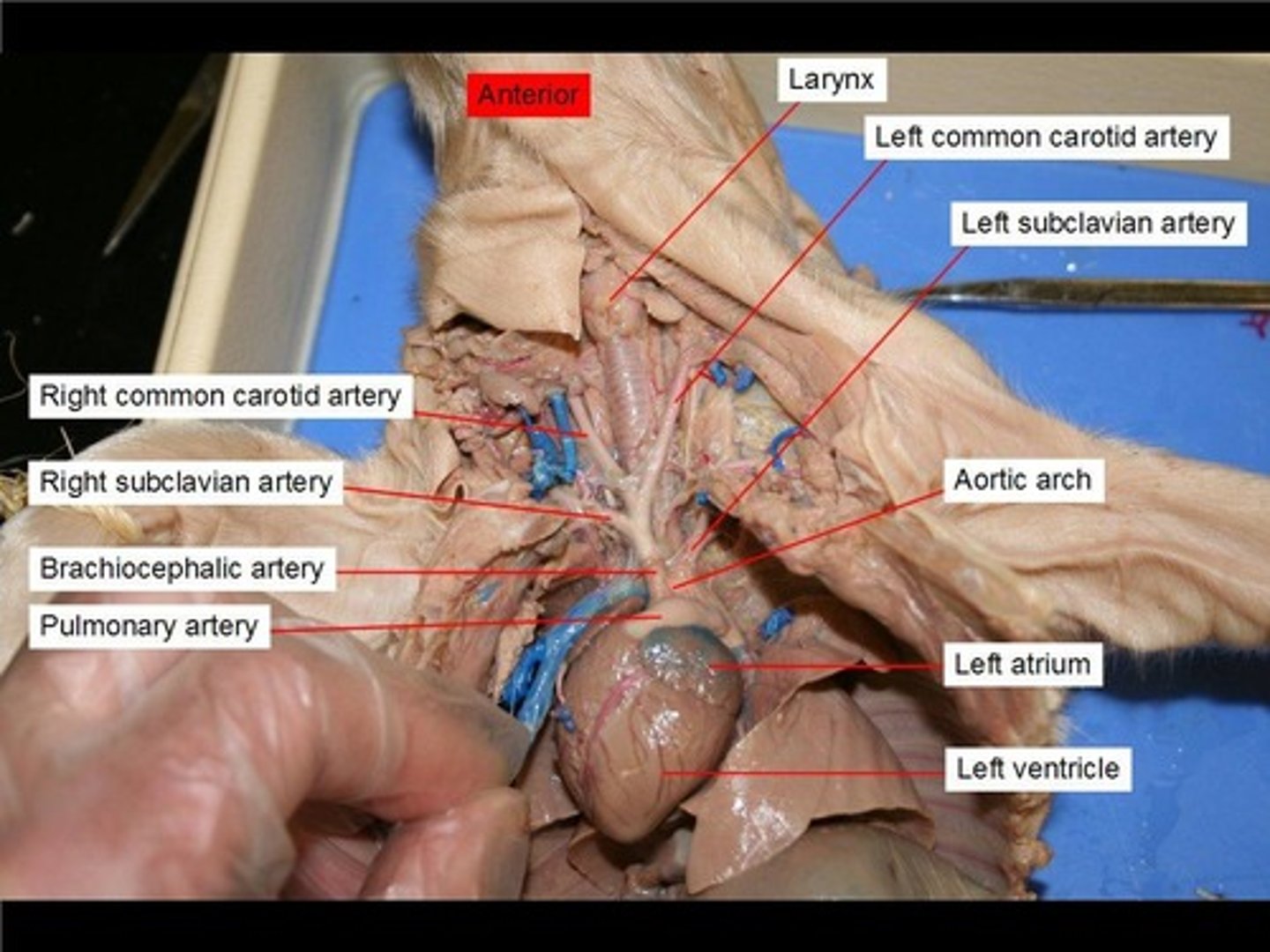 <p>L: next to the left atrium</p><p>F: vessel which carries blood from right ventricle to the pulmonary arteries</p>