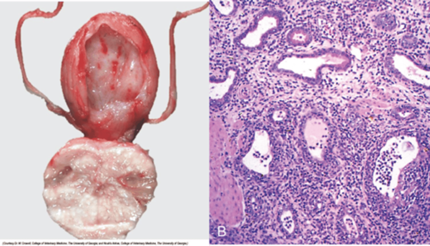 <p>Asymmetrical enlargement; may contain abscesses (untreated cases can develop into peritonitis or septicaemia/toxaemia).</p><p>- But chronic cases may be subclinical.</p>