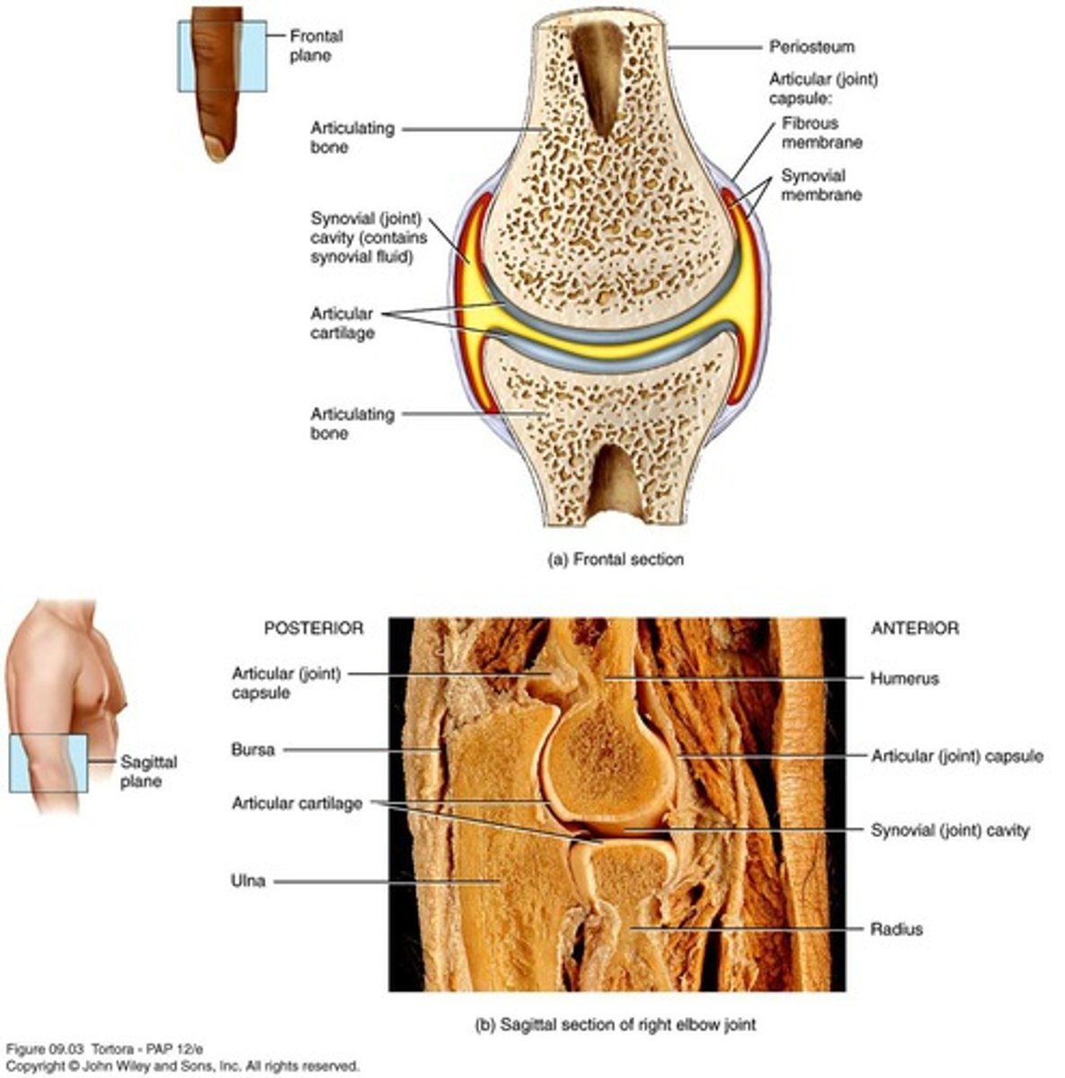 <p>Articular cartilage is hyaline cartilage that covers the ends of bones in synovial joints.</p>