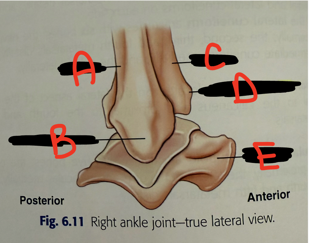 <p>A</p>
