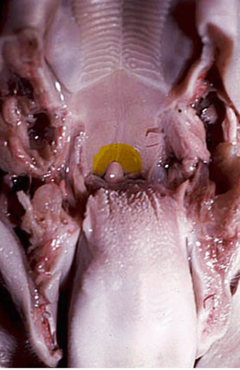 <p>Highlighted yellow</p>