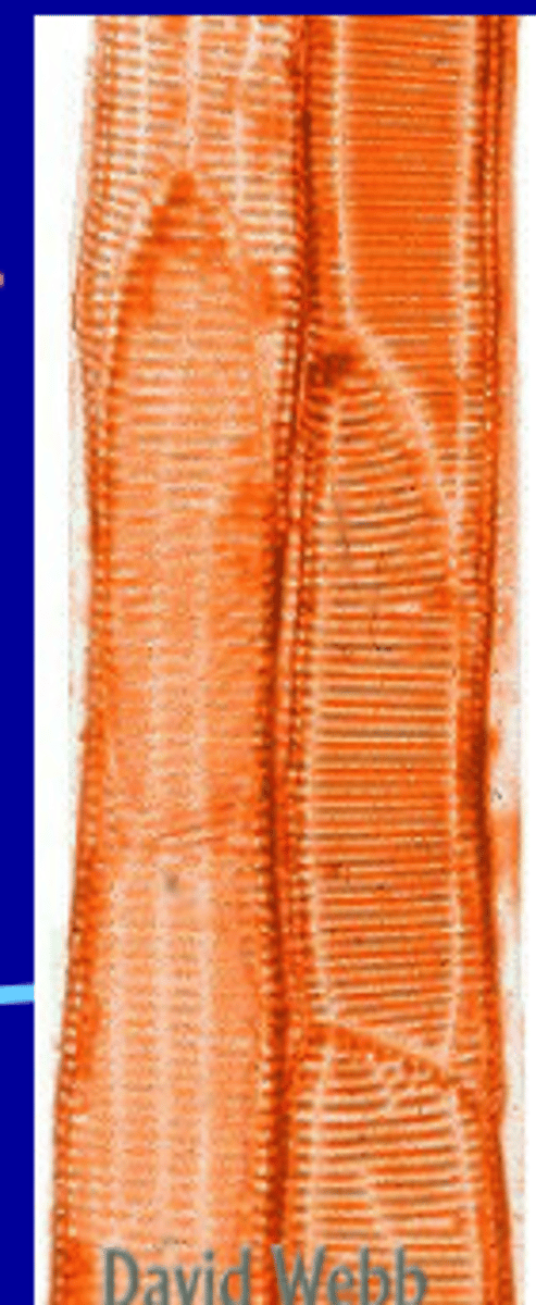 <p>In the xylem, long, pointy cells that have perforations (pits) so water can seep out into neighboring cells. Contain lignin in their cell walls and are dead at maturity.</p>