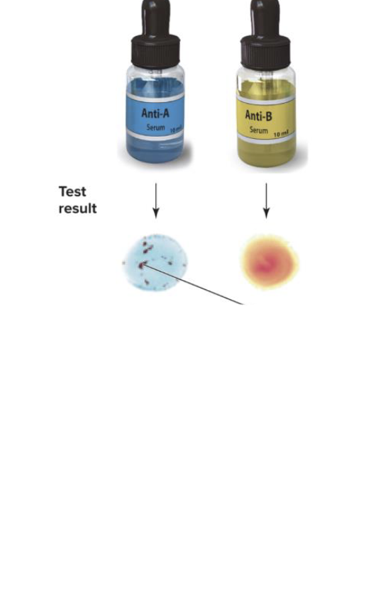 <p>Name the blood type</p>