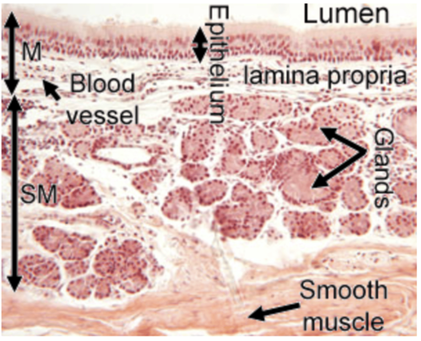 <p>contains connective tissue and accessory structures.</p><p>and may contain serous glands that secrete fluids to keep the respiratory epithelium moist and protect against pathogens.In some regions, the submucosa is absent or indistinct, merging with the lamina propria.</p><p>SM : Submucosa. (Trachea)</p>
