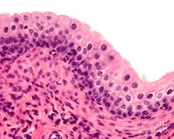 <p>transitional epithelium</p>