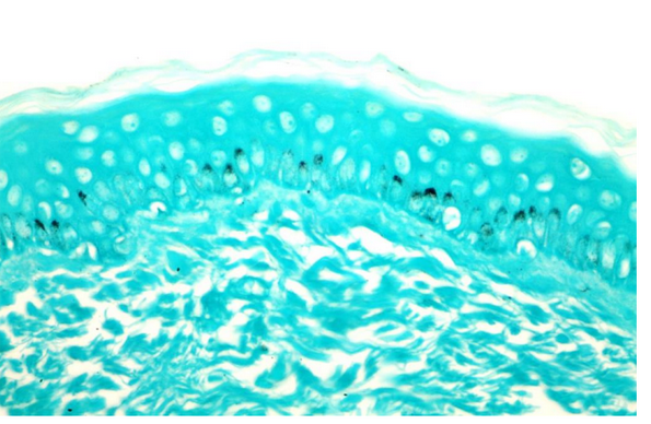 <p>quelle coloration</p>