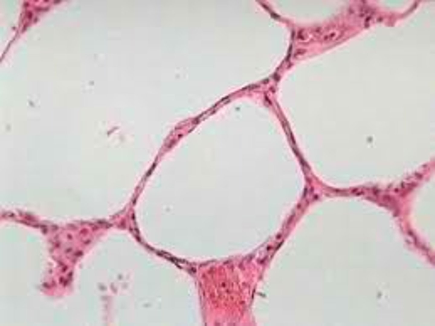 <p>(lung)</p>