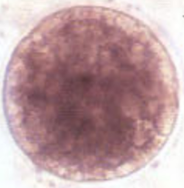 <p>Grade that embryo!</p><p>I am spherical and have uniform size, color, and texture</p>