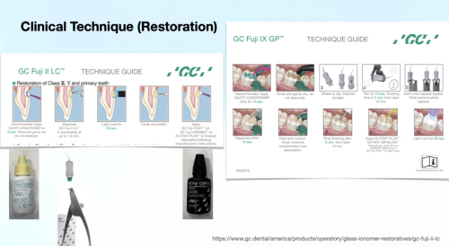<p>1. Apply Cavity Conditioner – 10 seconds</p><p>- Conditions enamel and dentin.</p><p>- Rinse and gently dry, but do not desiccate.</p><p>2. Activate and mix the capsule</p><p>- Shake/tap to loosen powder.</p><p>- Depress the plunger.</p><p>- Mix for 10 seconds (working time is ~2 minutes from start of mix).</p><p>- Insert into capsule applicator and “click” twice to prime.</p><p>3. Dispense material within 10 seconds</p><p>- Place directly into the preparation.</p><p>4. Pack and contour</p><p>- Avoid moisture contamination and excessive drying during this stage.</p><p>5. Final finishing after ~6 minutes from start of mix.</p><p>6. Apply surface coating</p><p>- Apply G-COAT Plus (or Fuji Varnish).</p><p>- DO NOT air blow before curing.</p><p>- Light cure the coating for 20 seconds.</p>