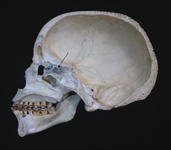 ethmoid sinus 
