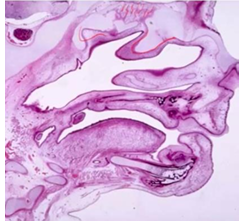 <p>-cribriform plate and lateral nasal cartilages</p>