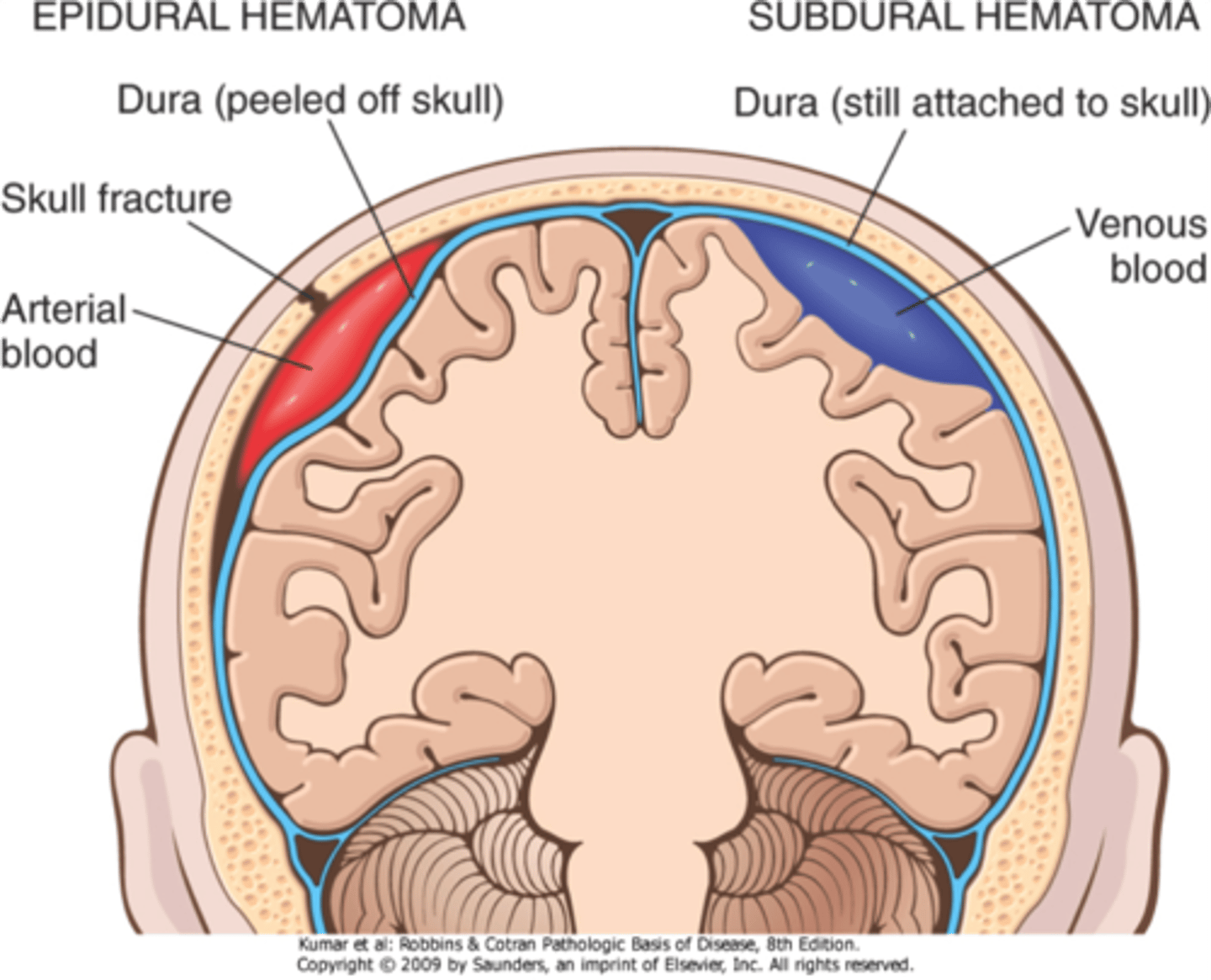 <p>mild or severe trauma that can result from a violent impact to the head</p>