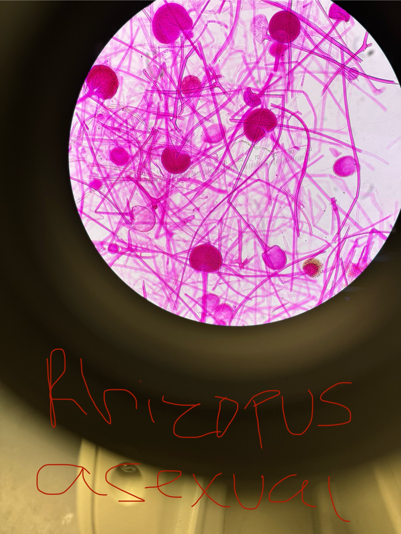 <p>Rhizopus stolonifer</p>