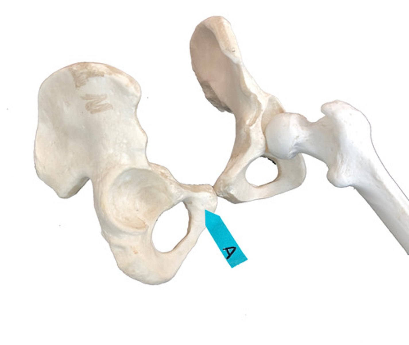 <p>Identify this bone that is one of 3 bones that fuse to form the coxal bone.</p>