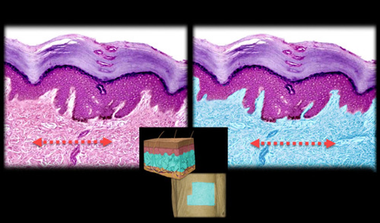 <p>- Located directly below the epidermis.</p><p>- Composed of two layers, the papillary layer (loose connective tissue) and the reticular layer (dense irregular connective tissue).</p><p>- Appears as a thicker, more fibrous layer compared to the epidermis, containing collagen and elastic fibers.</p><p>- Includes blood vessels, hair follicles, and glands embedded in the tissue.</p><p>- Papillary layer has finger-like projections (dermal papillae) that interlock with the epidermis, while the reticular layer appears denser with fewer cells.</p>