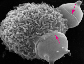 <p>What are the ruffles visible on the membrane of the macrophage? What are the engulfed cells?</p>