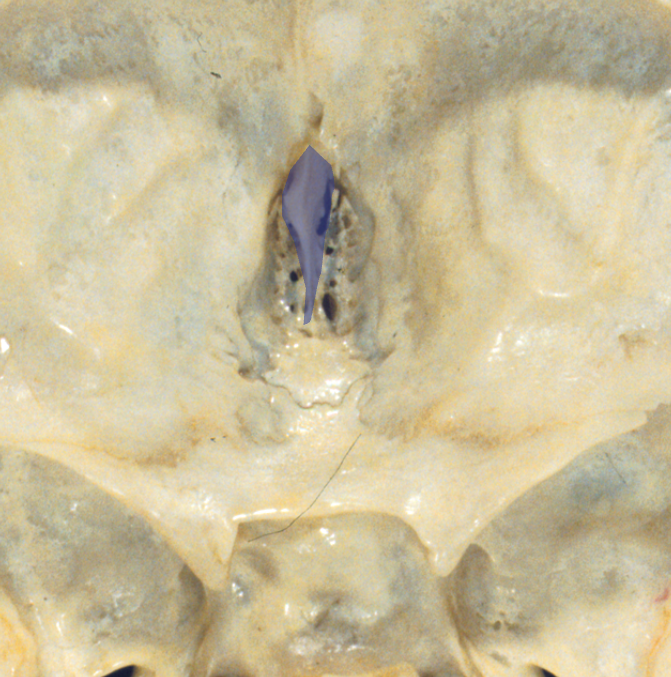 <p>What structure?</p>