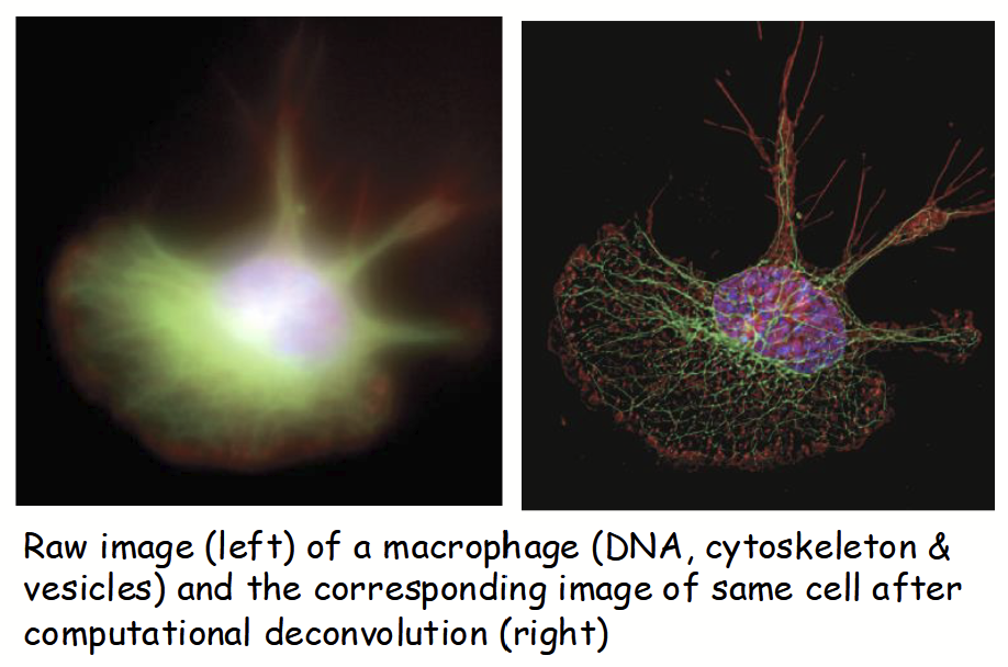 <p>Standard brightfield microscope - designed to remove background and out-of-focus light (yields high contrast and clarity).</p>