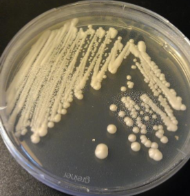 <p>Which sp is this? At which temperature?</p>