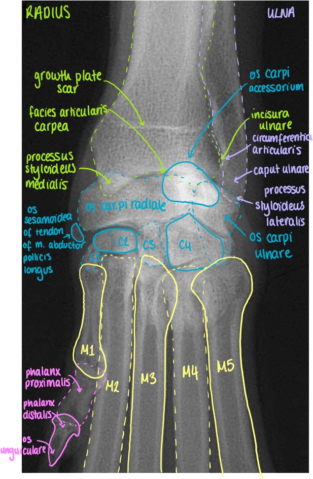 Dorso-Palmar Projection of the Articulatio Carpi