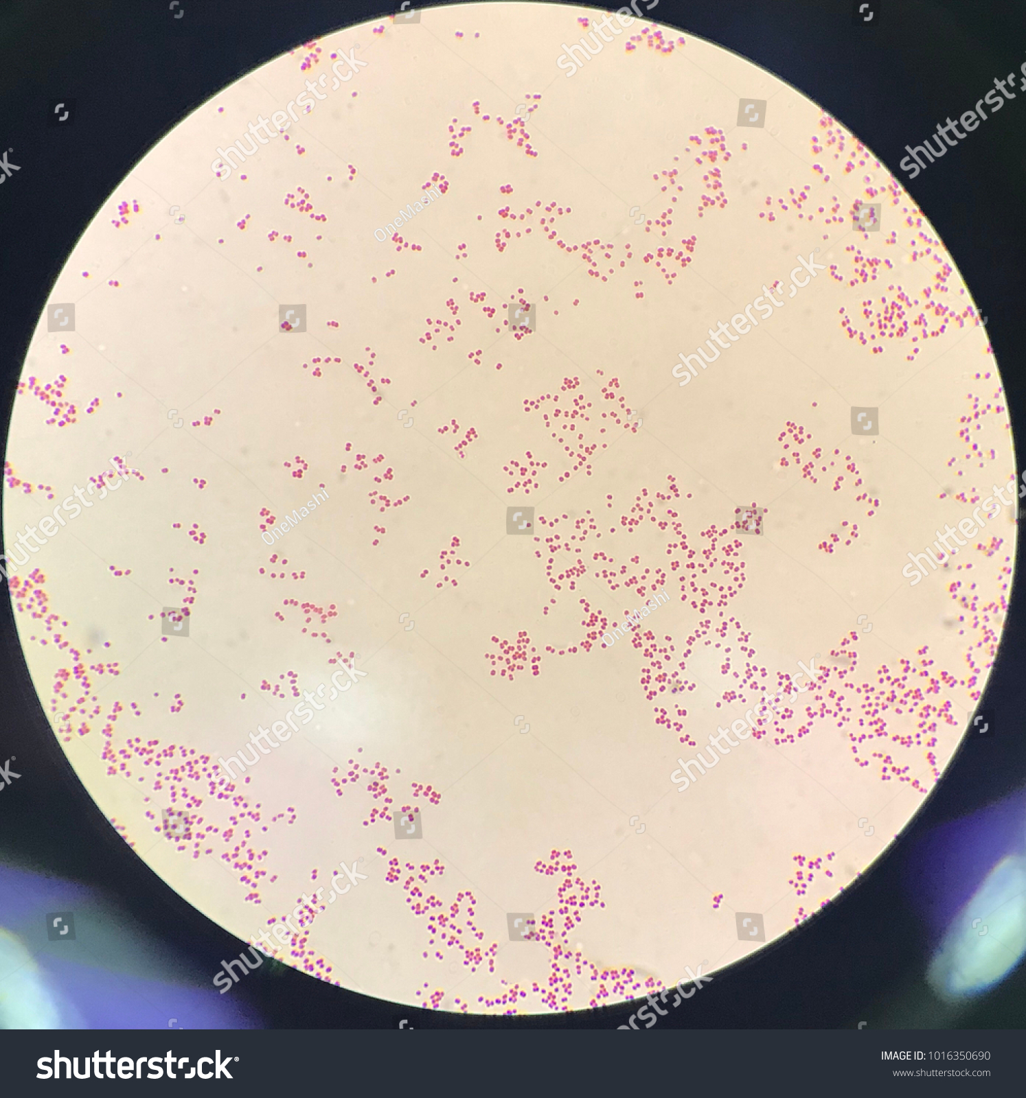 <p><strong> Pink diplococci (Gram-negative bacteria pairs of round cells).</strong></p><p>It causes gonorrhea, <strong>a sexually transmitted infection.</strong></p><p>Diagnosis is made through clinical symptoms such as genital discharge and dysuria, along with laboratory tests like NAATs or Gram stain.</p><p>Treatment is usually with <strong>ceftriaxone</strong>, and condoms help prevent infection.</p><p>It is unique because it <strong>only infects human</strong>s, shows high antigenic variation, and is becoming resistant to antibiotics.</p>