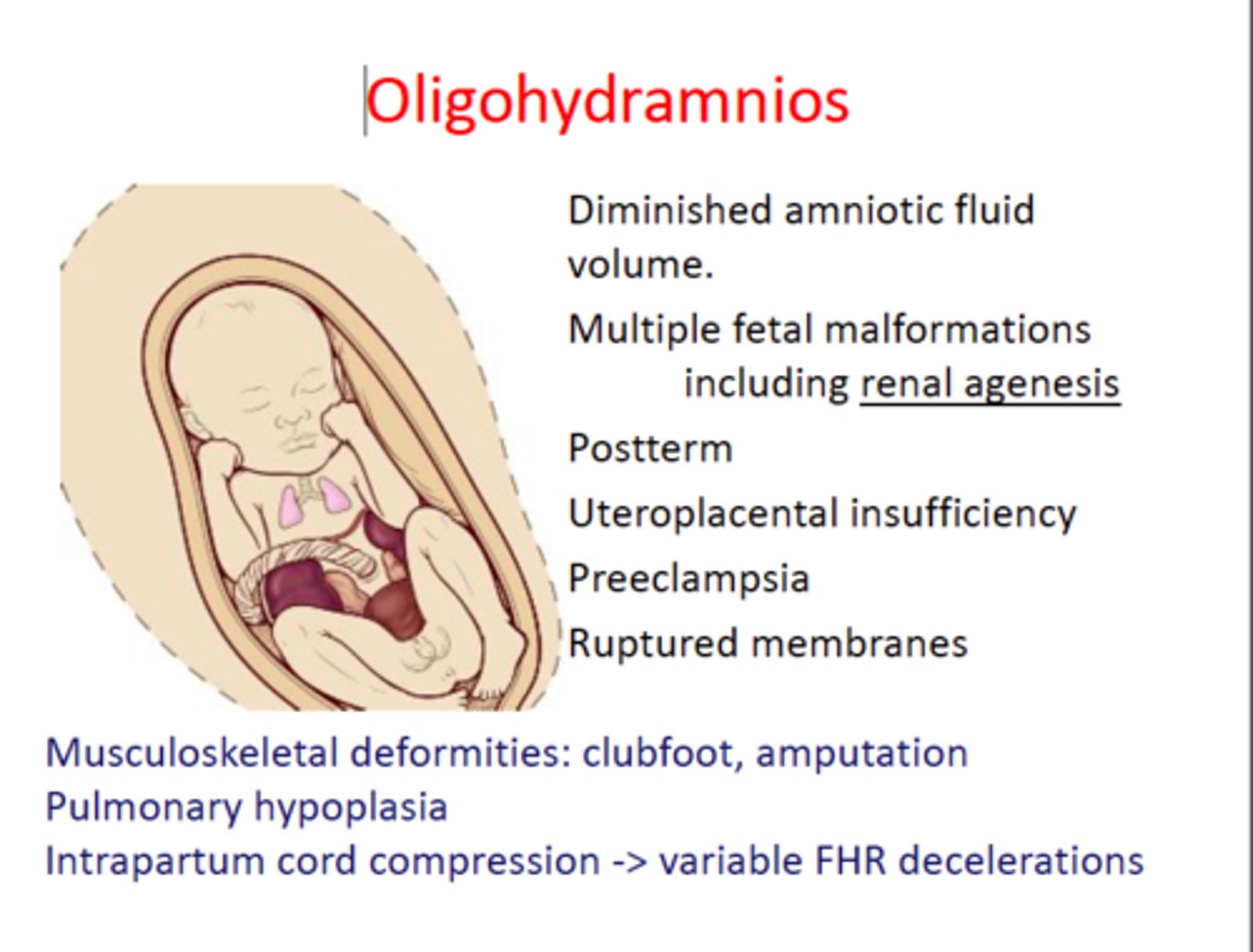 <p>Renal failure/agenesis, urinary tract obstruction, and placental insufficiency.</p>