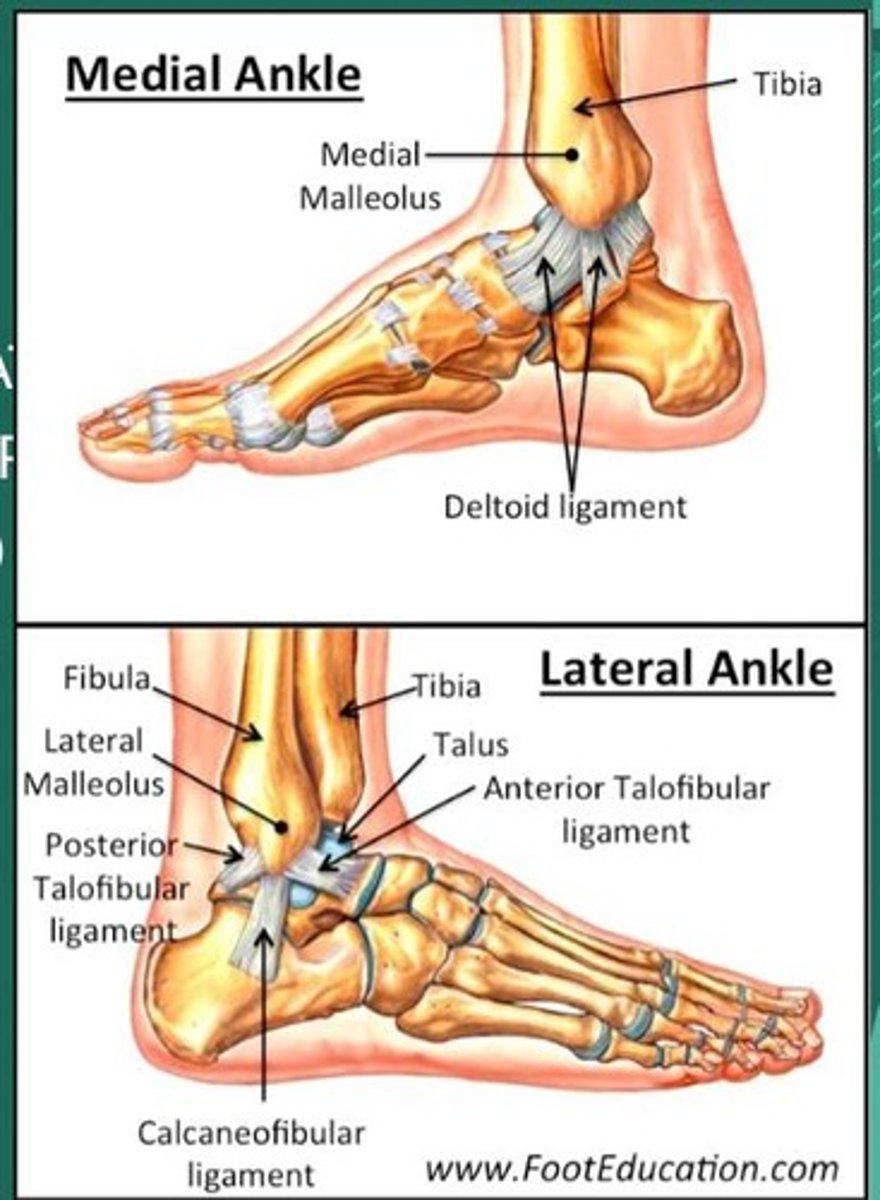 <p>85% of ankle sprains are caused by excessive inversion, others are caused by excessive eversion.</p>