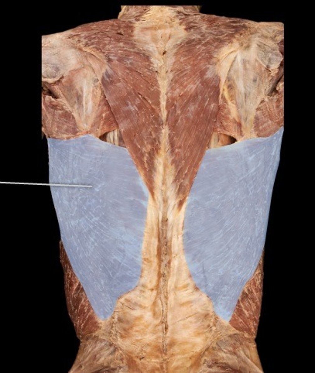 <p>What muscle is this?</p>