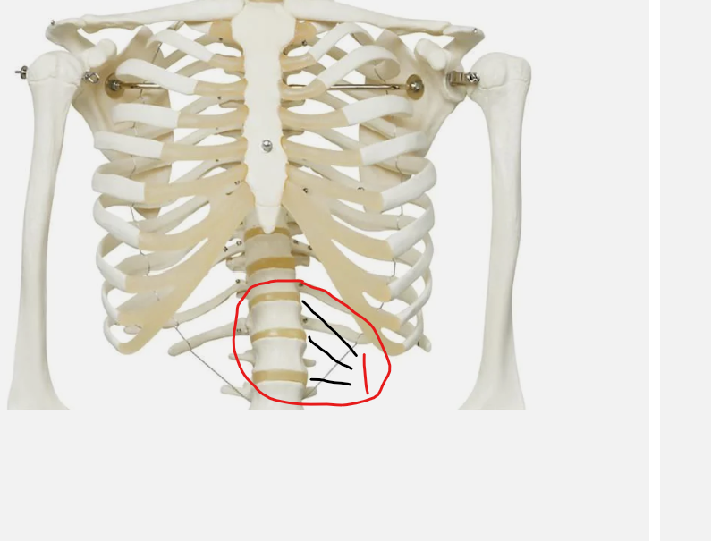 <p>what type of joint is this</p>