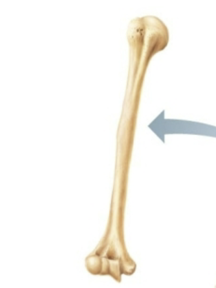 <p>What classification of bone is this?</p>