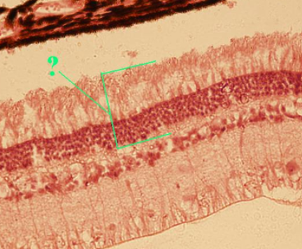 <p>Identify the indicated layer of the retina.</p>