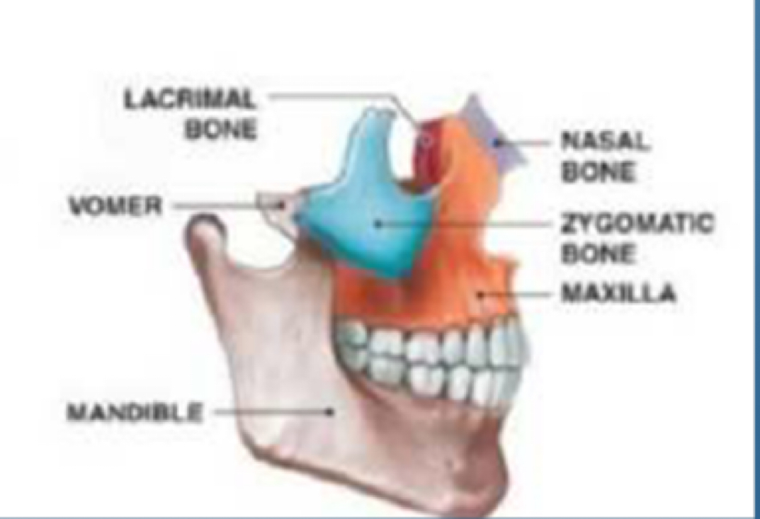 <p>Nasal bone,</p><p> Zygomatic,</p><p> Maxilla,</p><p> Mandible</p>